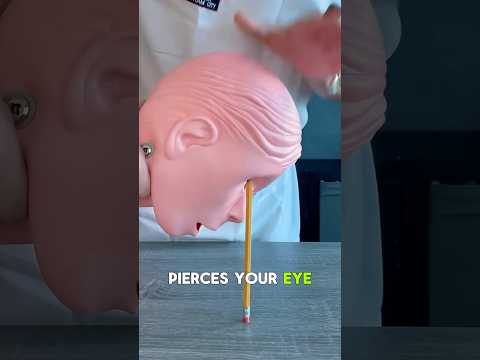 What to Do If a Pencil Stabs Your Eye 😱