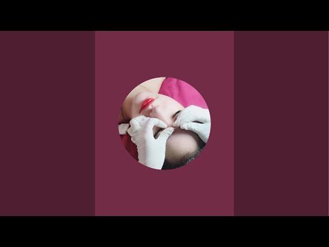 Điều trị mụn trứng cá - acne treatments