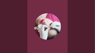 Điều trị mụn trứng cá - acne treatments