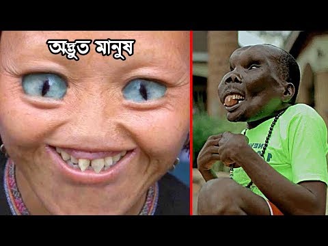 জন্মগতভাবে ব্যতিক্রমধর্মী ১০ জন অদ্ভুত মানুষ । Top 10 Unusual People with most Unique Features