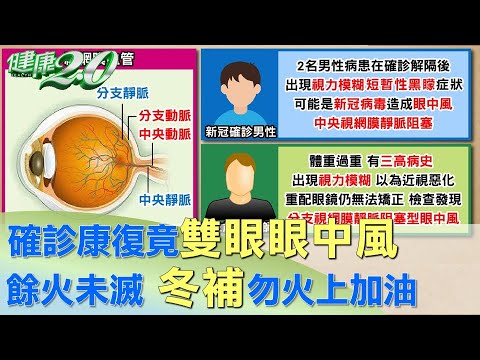 確診康復竟雙眼眼中風 餘火未滅 冬補勿火上加油 健康2.0