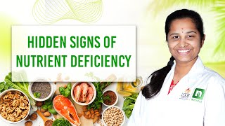 Hidden Signs Your Body is Screaming for Nutrients I #nutriful #NutrientDeficiency #HiddenHealthSigns