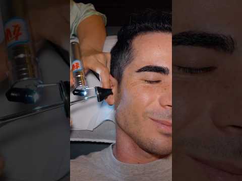 ASMR: Relaxing Chinese Ear Cleaing with Moxibustion and Head Massage #shorts