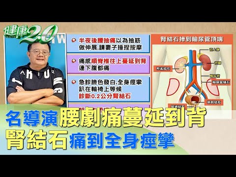 劇場名導腰劇痛蔓延到背 腎結石痛到全身痙攣 健康2.0