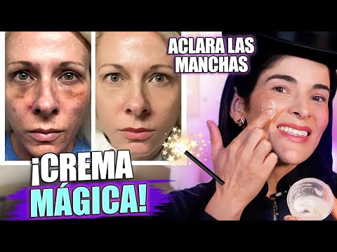 ¡CREMA MÁGICA Casera para ACLARAR MANCHAS, Maravillosa!