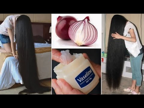 How to use Vaseline and onions to lengthen hair by 2 centimeters per day/very effective