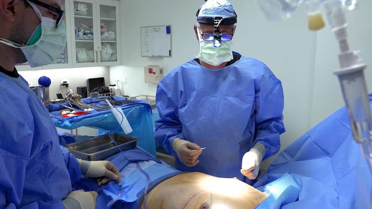 Dr. Grover performing gynecomastia surgery in Newport Beach