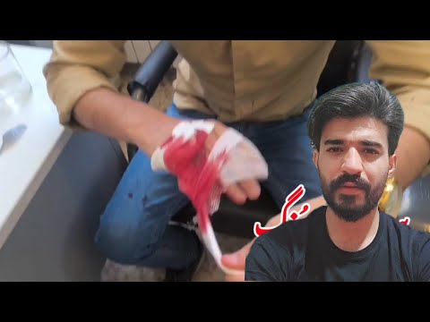 Attack on a nomadic teacher; a bitter reality from remote regions