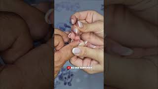 Mini cirurgia para retirada do dente! #primeirossocorros #curiosidades #fatos