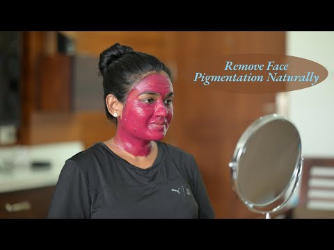 Remove Face Pigmentation Naturally | Skincare