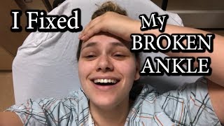 I FINALLY Had Ankle Surgery | Part 1