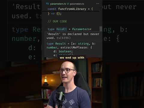 Parameters is SO helpful
