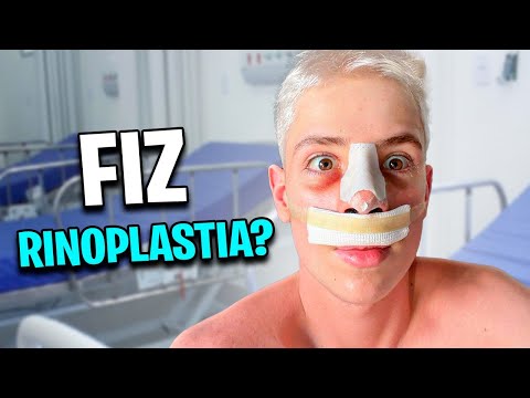 FIZ UMA CIRURGIA NO NARIZ!