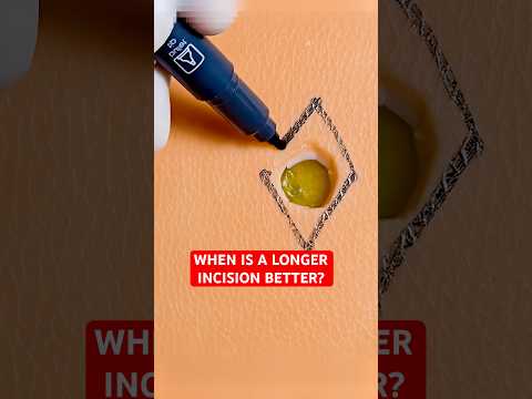 Longer Surgical Incision For Better Skin Healing⁉️ #shorts