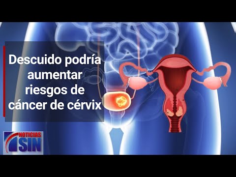 Descuido podría aumentar riesgos de cáncer de cérvix