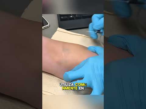 Técnica de Inyección Súper Rápida y Sin Dolor😲