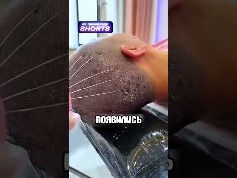 БЕГИТЕ в больницу если увидите это 😧