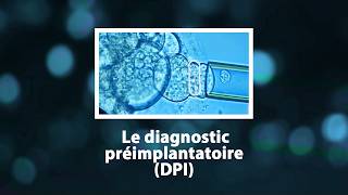 Le diagnostic préimplantatoire (DPI)