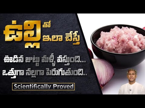 Onion for Hair Care | Home Remedy Onion for Hair Growth and Hair Fall | Dr.Manthena's Beauty tips