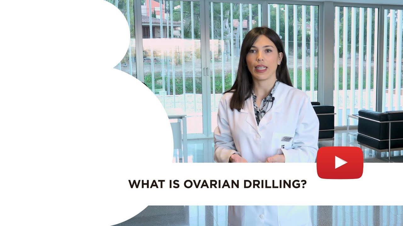 What is ovarian drilling?
