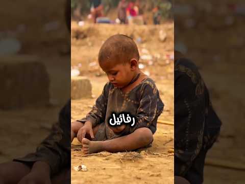 تم التخلي عن هذا الطفل منذ سنوات طويلة من قبل والديه ولم يقصد شعره لكن بعد سنوات كانت الصدمة
