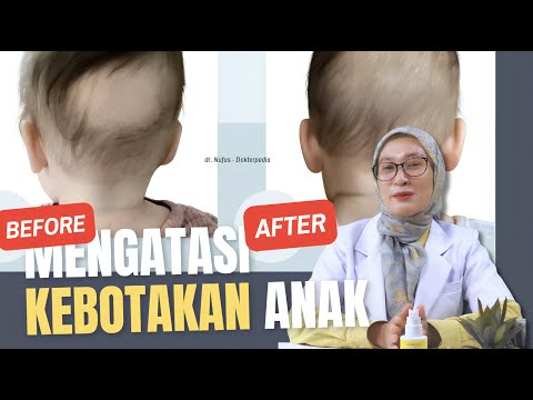 Mengatasi rambut anak rontok, coba ini untuk rambut anak lebat dan tumbuh cepat #HairtopiaSerum