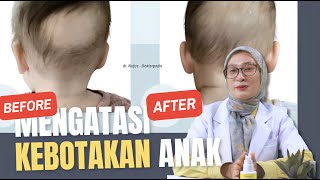 Mengatasi rambut anak rontok, coba ini untuk rambut anak lebat dan tumbuh cepat #HairtopiaSerum