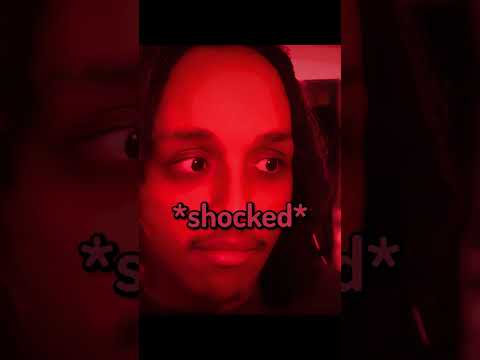 Streamers With HUGE Foreheads Pt 2 ๐ง