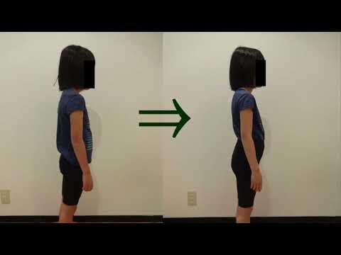 子供姿勢矯正の効果実績40 posture correction for child before and after