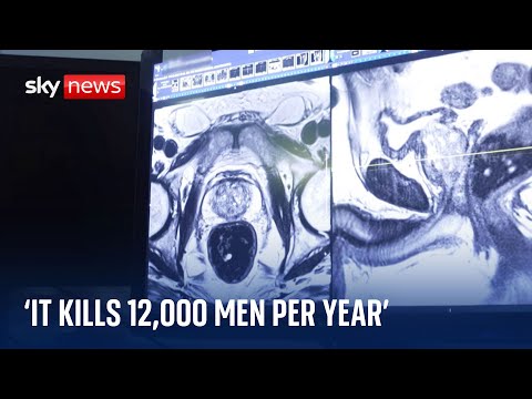 EU to start large-scale screening trial for prostate cancer