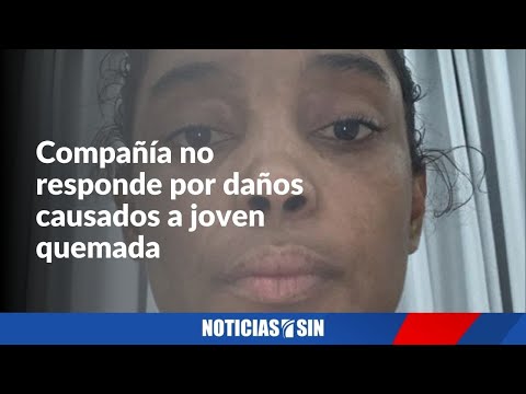 Constructora no se responsabiliza por daños causados a joven quemada