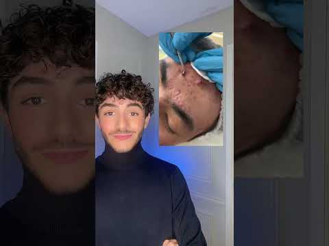 😭✅ C'EST PAS TROP SATISFAISANT À RETIRER ?