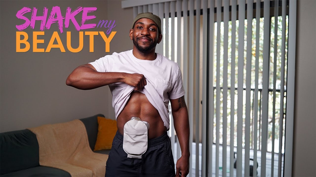 My ileostomy bag has helped me love my body - shake my beauty