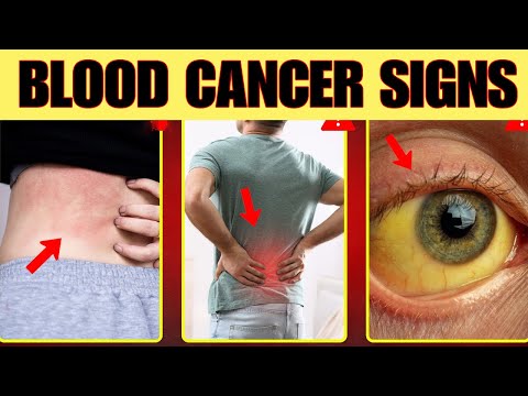 5 Silent Signs of Blood Cancer (Doctors Never Reveal These Early Signs)