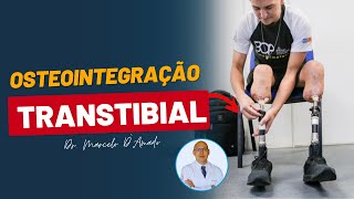 Osteointegração para Amputados Transtibiais!