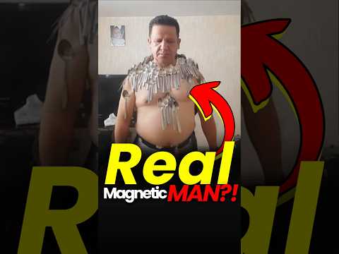 He Stuck 96 Spoons to His Body 😱