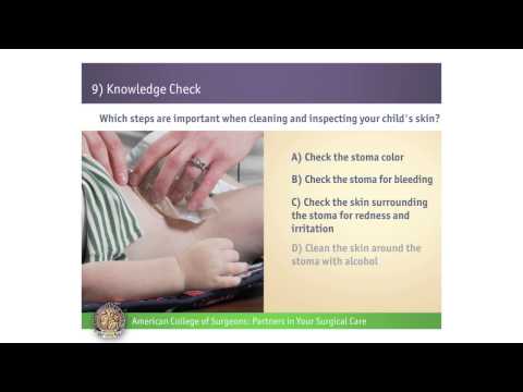 Pediatric Urostomy: Knowledge Check