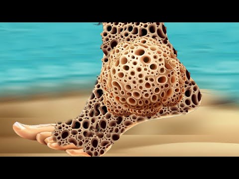 ASMR ANIMATION TREATMENT | Removal of Ticks