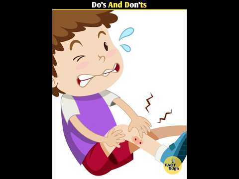 What to Do's and Don'ts when Snakes Bite 🤯 #shorts #facts