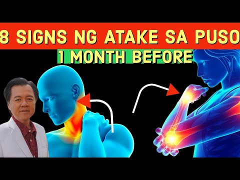 8 Warning Signs ng Atake sa Puso Bago Ito Mangyari. - By Doc Willie Ong