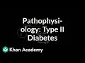 Exploring Pathophysiology of Type II Diabetes