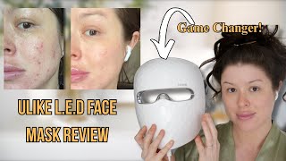 Ulike LED Face Mask | Red Light Therapy Mask at Home – Does It Actually Work? With Before & After!