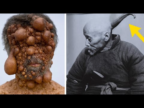Le 9 Mutazioni Genetiche Più Terribili👨‍🔬👩‍⚕️