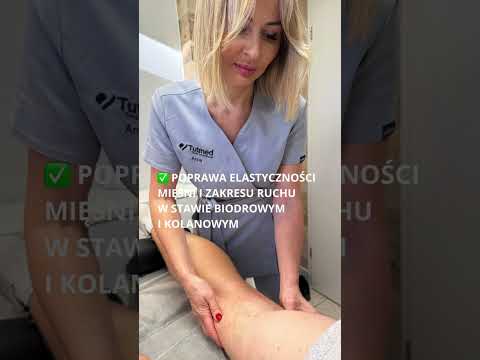 Ból z tyłu uda? Zobacz, jak terapia manualna pomaga uwolnić napięcie! 💪 #FizjoterapiaRzeszów