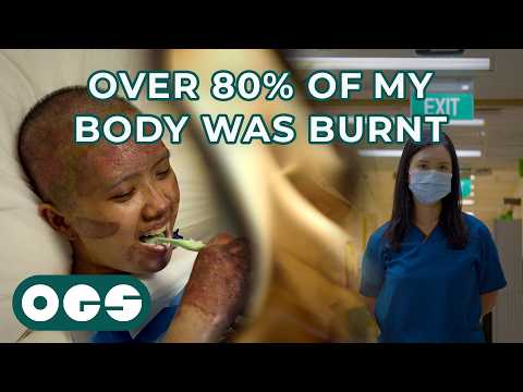 The Doctor with Third Degree Burns