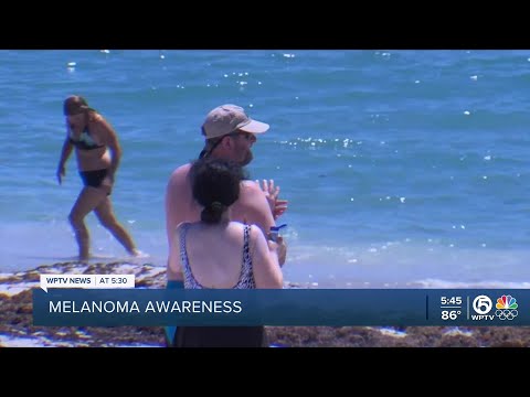 Melanoma Awareness Month: How to prevent melanoma