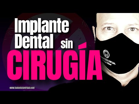 La NUEVA FORMA de REEMPLAZAR DIENTES PERDIDOS que POCOS CONOCEN!