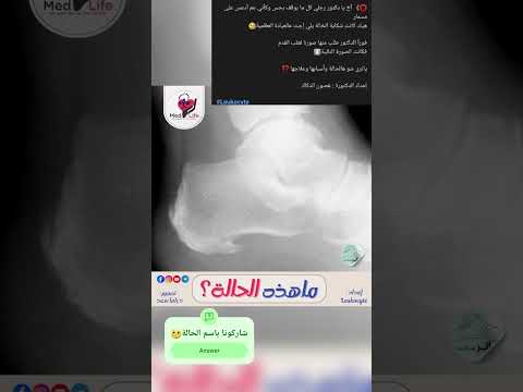 إعداد الدكتورة : غصون الدكاك #Leukocyte#Med_life