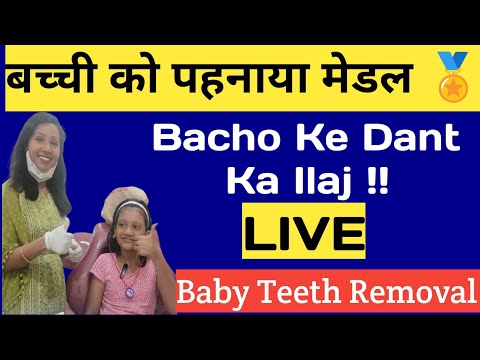 Bacho Ke Dant | Baby Teeth Treatment |Bacho Ke Dant Kaise Nikalte Hai |Milk Teeth Removal |Cost