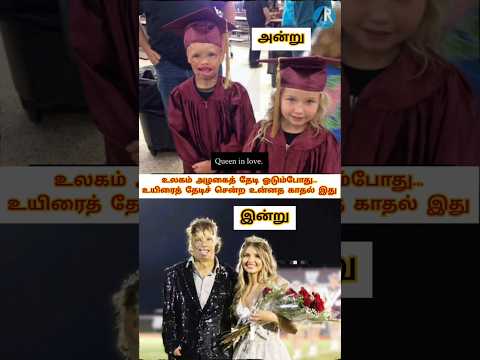 உலகம் அழகைத் தேடி ஓடும்போது...உயிரைத் தேடிச் சென்ற உன்னத காதல் இது